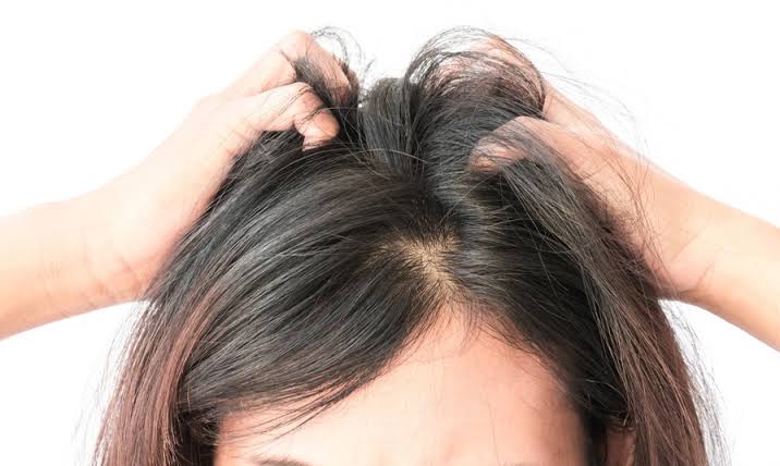 زراعة الشعر للنساء في آيكونا كلينيك
