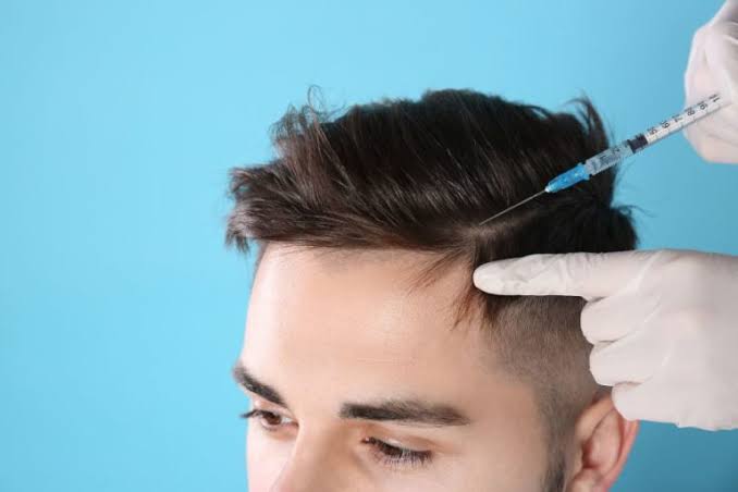 ضمان زراعة الشعر في آيكونا كلينيك