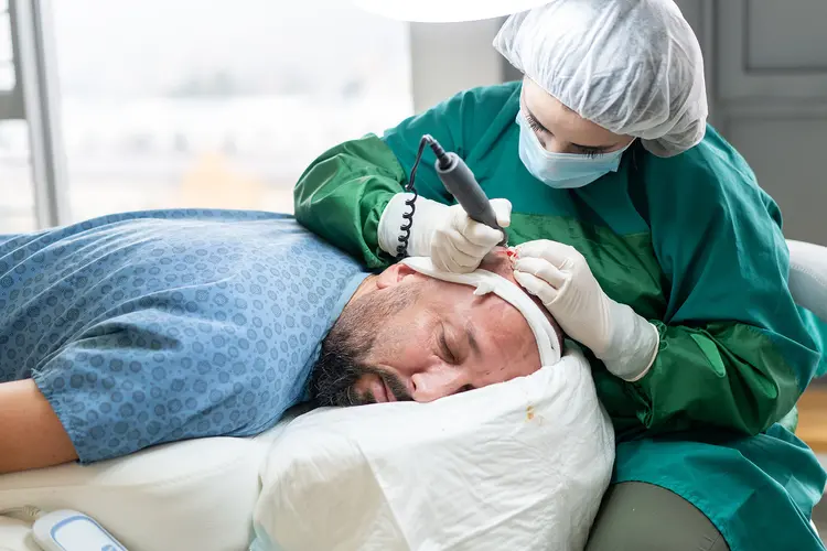 زراعة الشعر مع تقنية النوم العميق في آيكونا كلينيك
