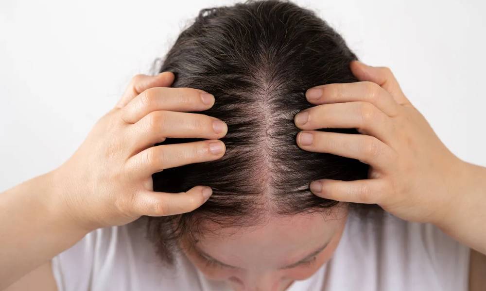 بالصور-زراعة-الشعر-للنساء